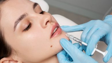 What Areas Can Dermal Fillers Enhance?